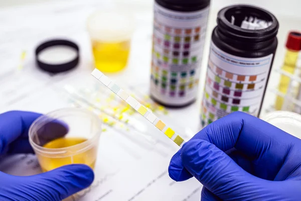 Test Urine Réalisé Avec Flacon Bandelette Réactif Analyse Urine Utilisé — Photo
