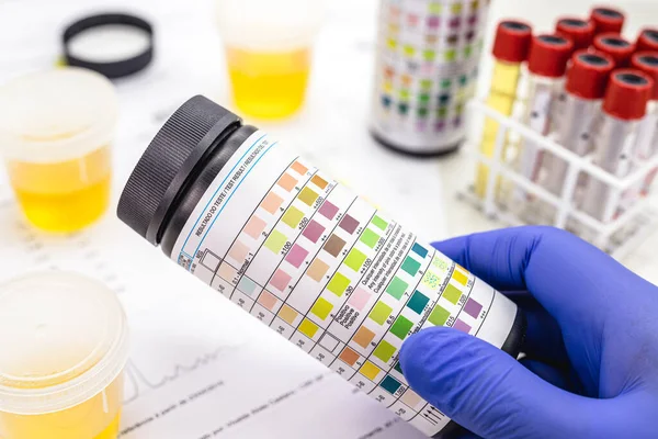 Vial Urinalysis Test Strip Used Ketosis Control Other Parameters Asleukocytes — Stock Photo, Image