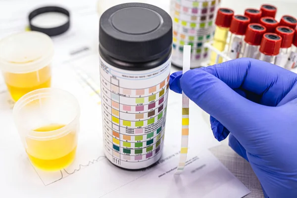 İdrar testi. Ketozis kontrolü için kullanılan idrar testi tüpüyle yapılmış. Laboratuvar incelemesi..
