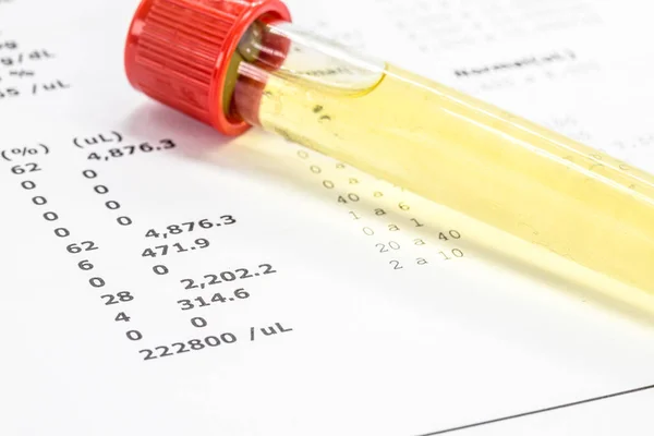 Urine Vial Laboratory Toxicology Routine Examination — Stock Photo, Image