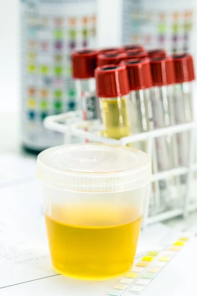 Urinflasche Labor Der Toxikologie Oder Bei Routineuntersuchungen — Stockfoto