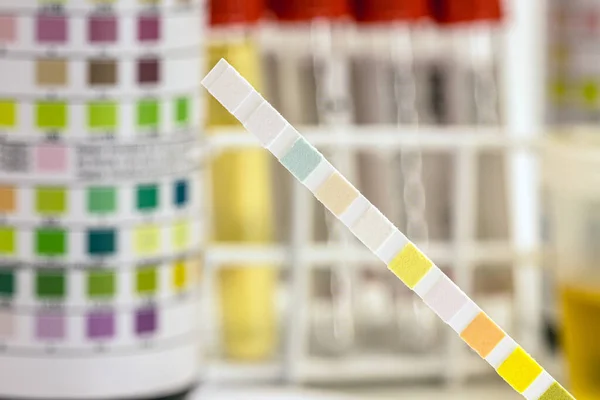 Reagent Strips Used Urinalysis Analyze Leukocytes Urobilinogen Bilirubin Blood Nitrite — Stock Photo, Image