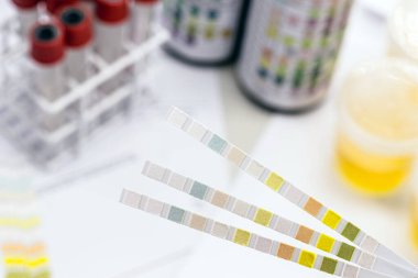 Lökosit, Urobiojen, Bilirubin, Kan, Nitrit, PH, Yoğunluk, Protein, Glikoz ve Ketoz vücutlarını analiz etmek için kullanılıyor..