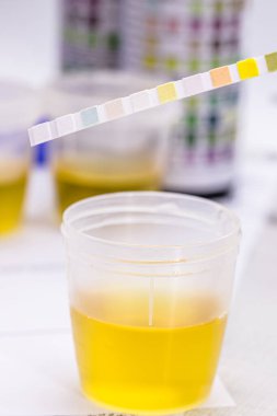 Lökosit, Urobiojen, Bilirubin, Kan, Nitrit, PH, Yoğunluk, Protein, Glikoz ve Ketoz vücutlarını analiz etmek için kullanılıyor..