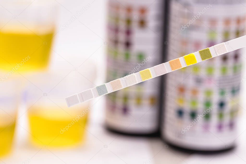 reagent strips used in urinalysis to analyze Leukocytes, Urobilinogen, Bilirubin, Blood, Nitrite, pH, Density, Protein, Glucose and Ketosis bodies.