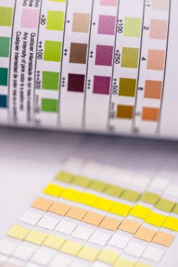 Ketozisi ve diğer 9 parametreyi kontrol etmek için kullanılan idrar bandı şeridi şeritli şişe.