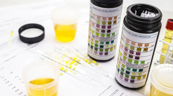 Urinalysis Reagent Strip Used Ketosis Control Other Parameters Eas Type — 스톡 사진