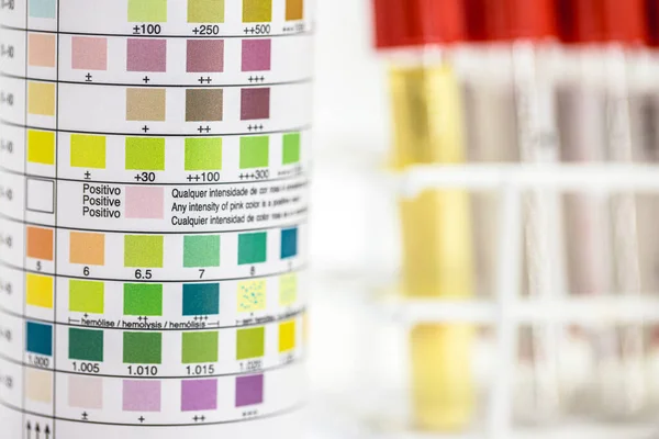 Vial Test Strips Urinalysis Used Control Ketosis Other Parameters Laboratory — Foto de Stock