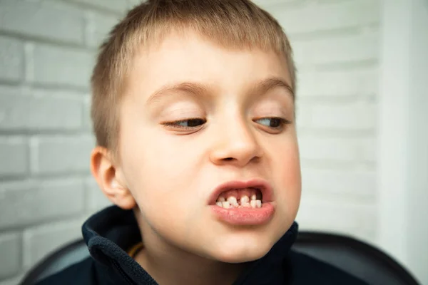 Chlapec ve věku 6-7 let ukazuje první zuby, které rostou po ztrátě mléčných zubů. Detailní záběr na chlapeckou tvář — Stock fotografie
