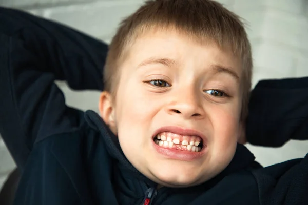 Menino Anos Idade Mostra Primeiros Dentes Que Crescem Após Perda — Fotografia de Stock