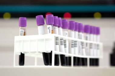 Milan, İtalya - 18 Kasım 2020: Analiz laboratuvarında bir rafta kan tüplerinin sıralanması