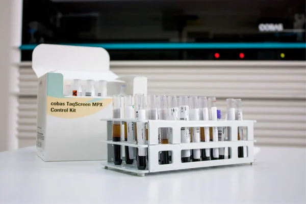 Milão Itália Novembro 2020 Classificação Tubos Sangue Rack Laboratório Análise — Fotografia de Stock