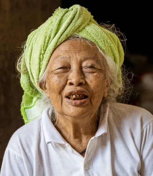 Old Woman Black Teeth Looks Camera — Foto de Stock