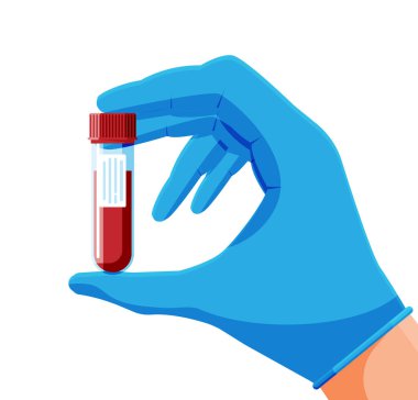 Doktor 'un elinde kan örneği olan test tüpü izole edildi. Genel Kan Analizi. Kırmızı Sıvı ile laboratuvar konteynırı. Tıbbi Plastik Torba. Araştırma, Tıbbi Analiz. Çizgi film Düz Vektör İllüstrasyonu