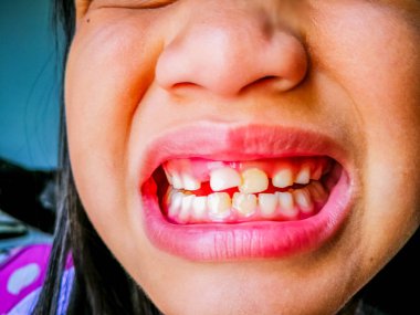 Arka plandaki çocuk dişlerini kapat