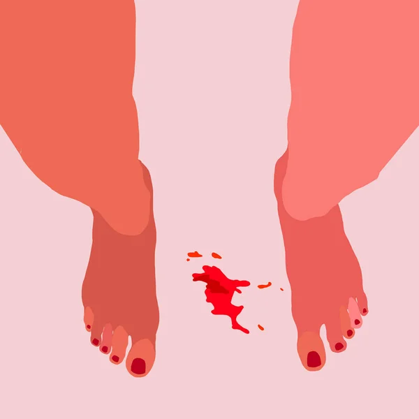 Девочки, пятна крови. Тема менструации, точка. Женская гигиена. Стоковый вектор
