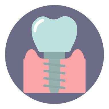 Diş implantı sakız, ikon, vektör. Tıbbi konsept, diş illüstrasyonu