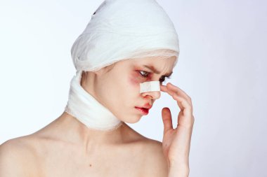 Burnu yaralı, yüzü yaralı bir kadın tamponu.