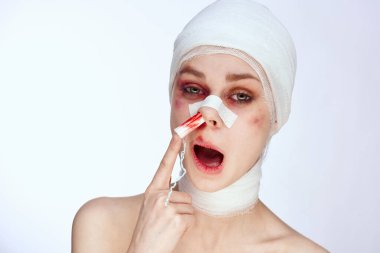 Burnu yaralı, yüzü yaralı bir kadın tamponu.