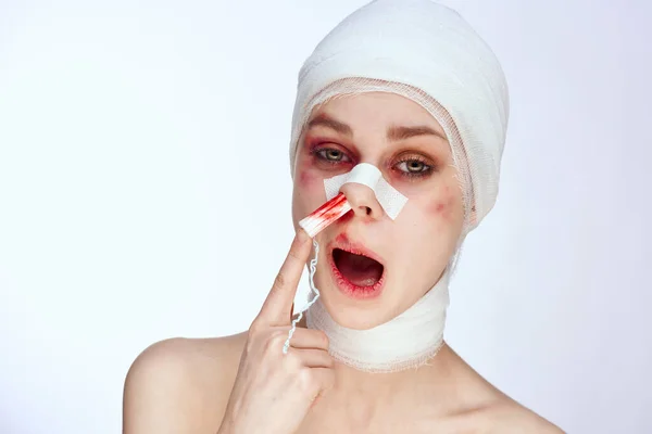 Женщина тампон в носу с кровью травмированное лицо изолированный фон — стоковое фото