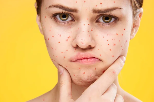 Female face cropped view red dots on the face skin problems — Stock Photo, Image