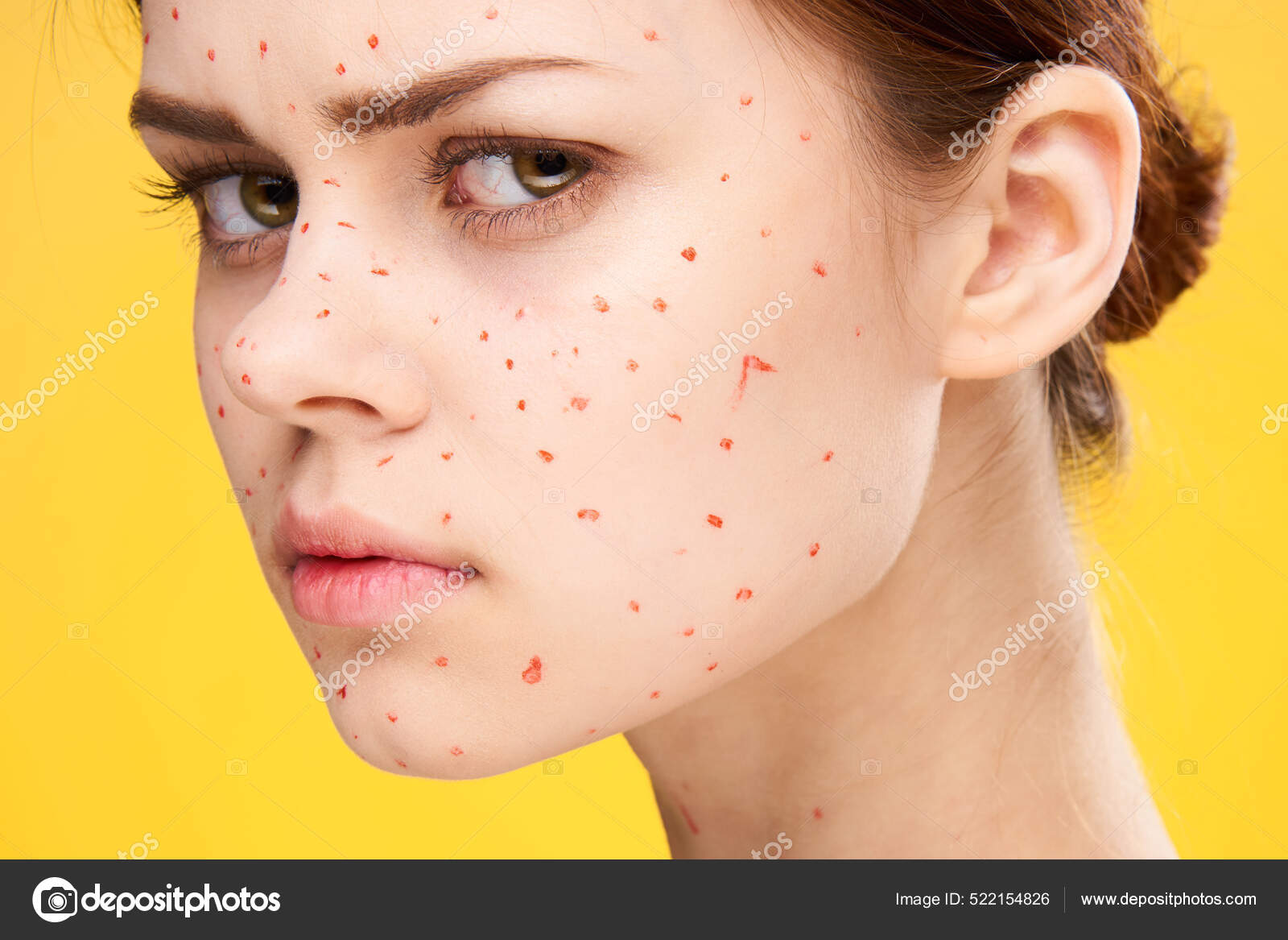 Woman with red dots on her face skin problems dermatology