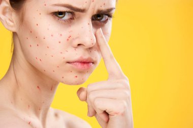 Yüzünde kırmızı noktalar olan kadın cilt sorunları dermatoloji tatminsizliği