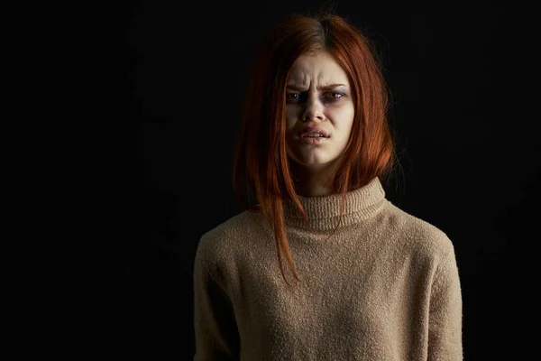 Vörös hajú nő, zúzódásokkal a szeme alatt, rémült síró depresszióval. — Stock Fotó