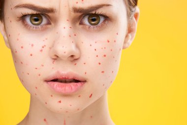 Yüzünde kırmızı noktalar olan kadın cilt sorunları dermatoloji tatminsizliği