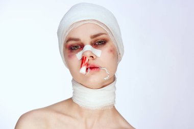 Burnu kanla yaralanmış bir insan tamponu stüdyo yaşam tarzı