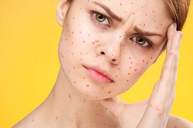 Yüzünde kırmızı noktalar olan kadın cilt sorunları dermatoloji tatminsizliği