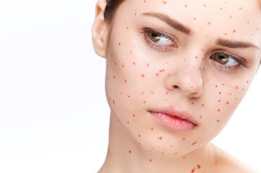 Çıplak omuzlu, dermatoloji sivilceli neşeli bir kadın.