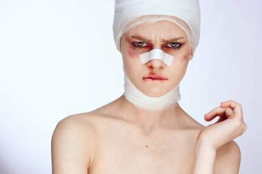 Burnu yaralı, yüzü yaralı bir kadın tamponu.