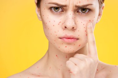 Yüzünde kırmızı noktalar olan kadın cilt sorunları dermatoloji tatminsizliği