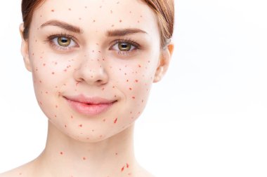 Çıplak omuzlu, dermatoloji sivilceli neşeli bir kadın.