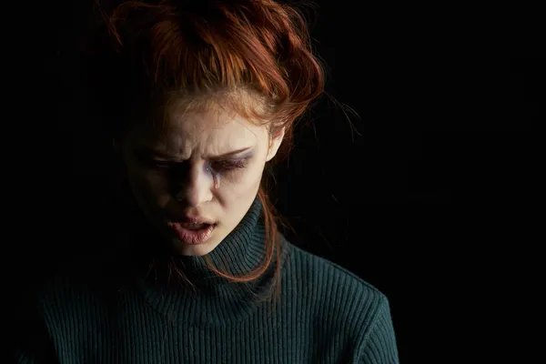 Rémült ideges nő zúzódásokkal a szeme alatt problémák visszaélés depresszió — Stock Fotó