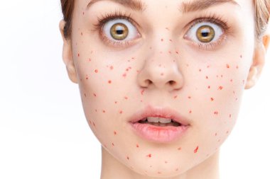 Çıplak omuzlu, dermatoloji sivilceli neşeli bir kadın.