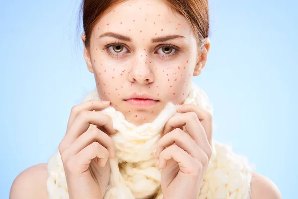 woman with red dots on her face with a scarf dermatology skin problems