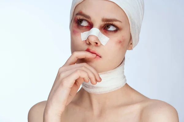 Retrato de una mujer con moretones tratamiento de la medicina de la cara lesión accidente primer plano — Foto de Stock