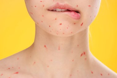 Kadın yüzü, yüz derisindeki kırmızı noktalar ile kırpılmış.