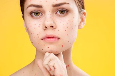 Yüzünde kırmızı noktalar olan kadın cilt sorunları dermatoloji tatminsizliği