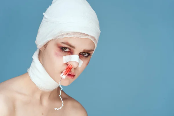 Nő tampon az orrban a vér sérült arc elszigetelt háttér — Stock Fotó
