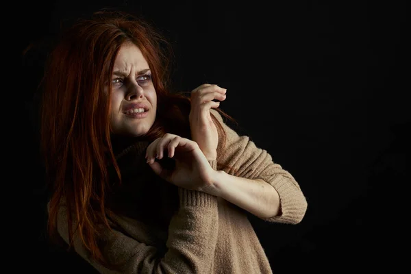 Rémült nő zúzódásokkal a szeme alatt verés depresszió visszaélés — Stock Fotó