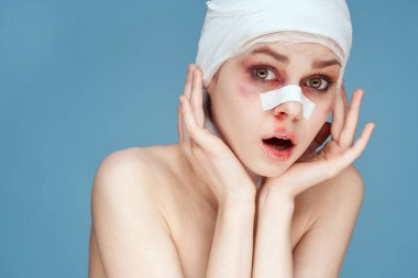 Kadın hasta bandajlı yüz çürükleri çıplak omuzlar hoşnutsuz mavi arka plan