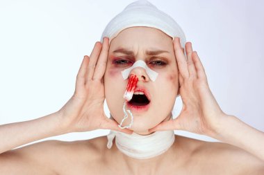 Burnu yaralı duygusal kadın tamponu. Stüdyo hayatı gibi.