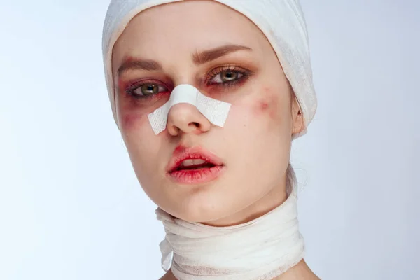 emotional woman bruised face medicine treatment injury accident studio lifestyle