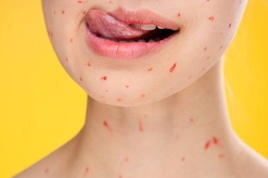 Kadın yüzü, yüz derisindeki kırmızı noktalar ile kırpılmış.