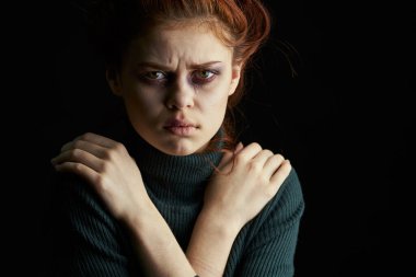 Gözü morarmış ağlayan kadın tacize uğramış.