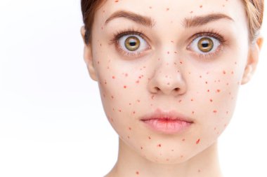 Çıplak omuzlu, dermatoloji sivilceli neşeli bir kadın.
