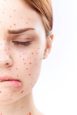 Çıplak omuzlu, dermatoloji sivilceli neşeli bir kadın.